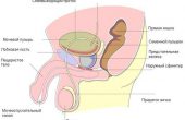 Медикаментозное лечение простатита