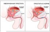 Где простата у мужчин и зачем она нужна ?